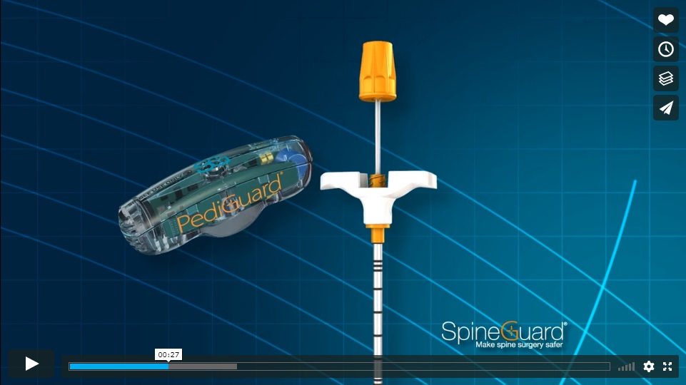 Video SpineGuard Canulat